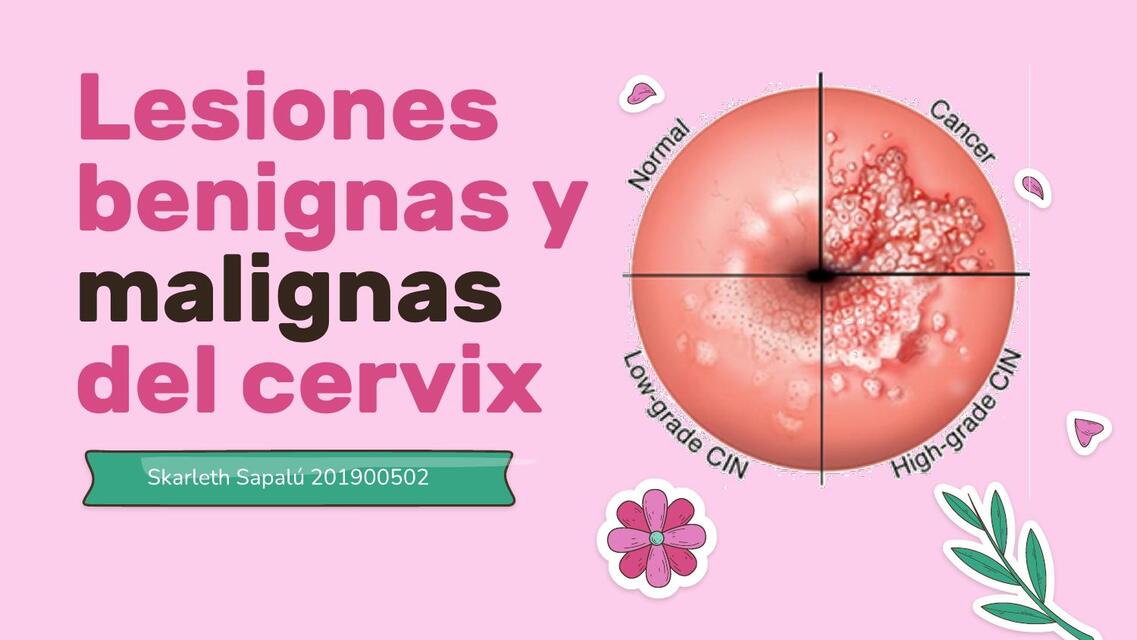 Lesiones benignas y malignas del cérvix 