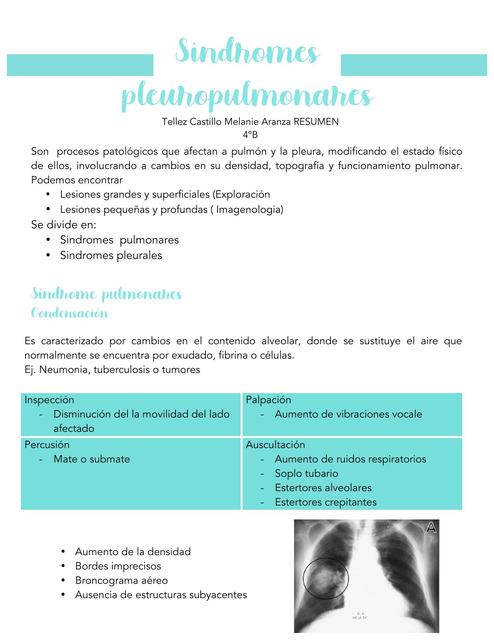 Sindromes pleuropulmonares PDF