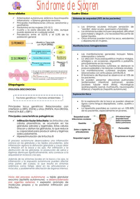 Síndrome de Sjögren