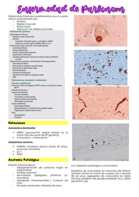 Enfermedad de Parkinson