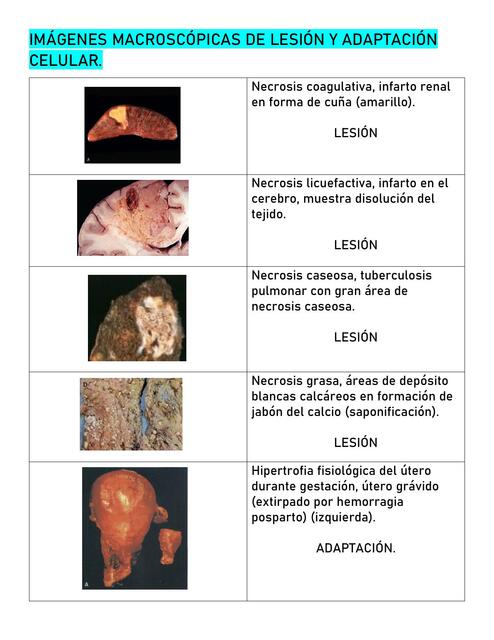 Imágenes macroscópicas de lesion y adaptacion celular  