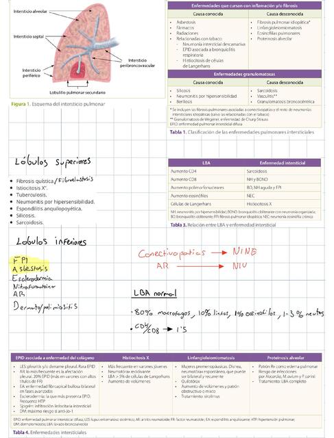 Enfermedades pulmonares intersticiales 