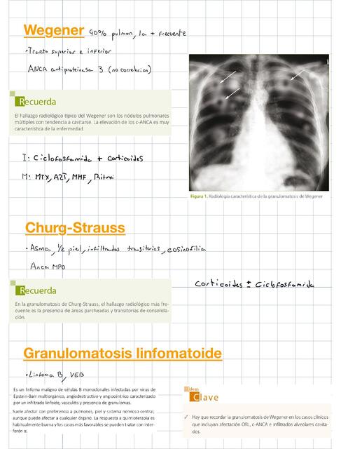 Vasculitis