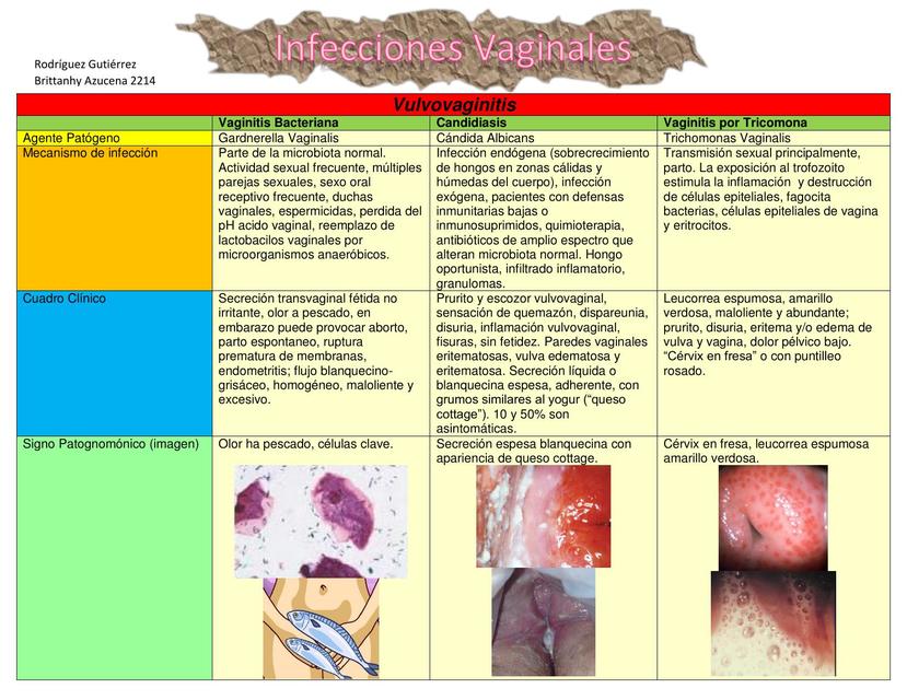 Infecciones Vaginales/ Integración Básico Clínica