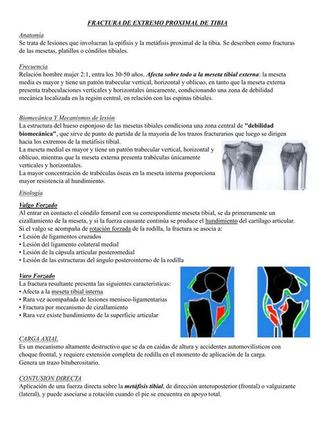 Fractura de Tibia