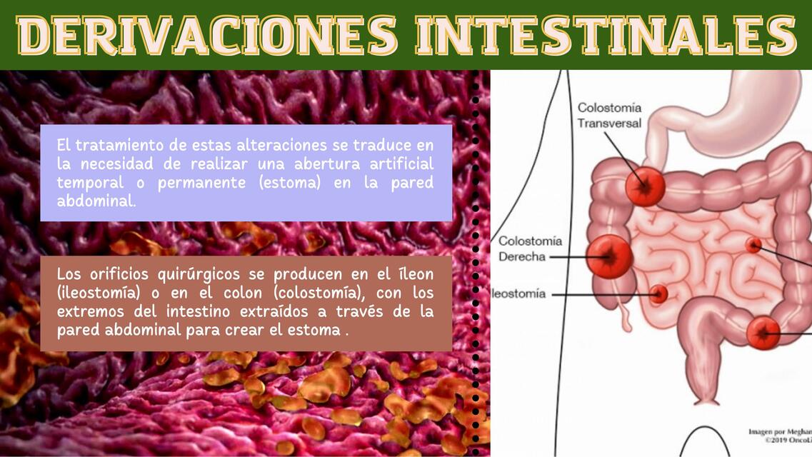 DERIVACION INTESTINAL | MARLEY ROSALIND ELIZAMA VERA BARRETO | uDocz