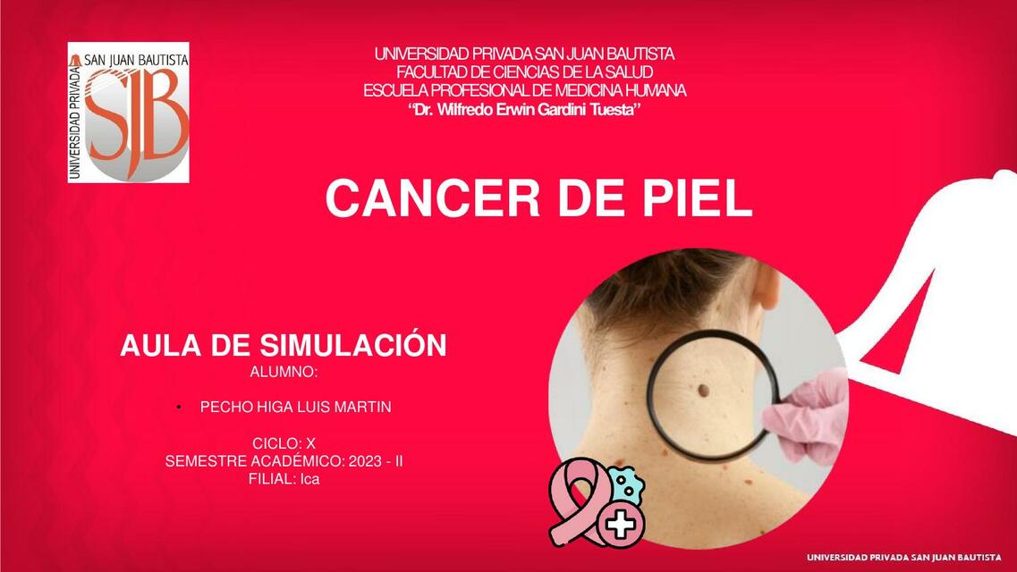 Cáncer de piel 