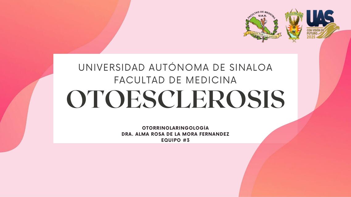 Otosclerosis otorrino