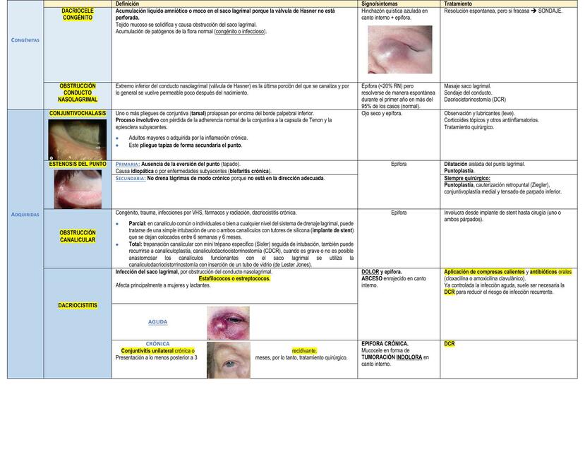 Resumen fisiopatología ocular