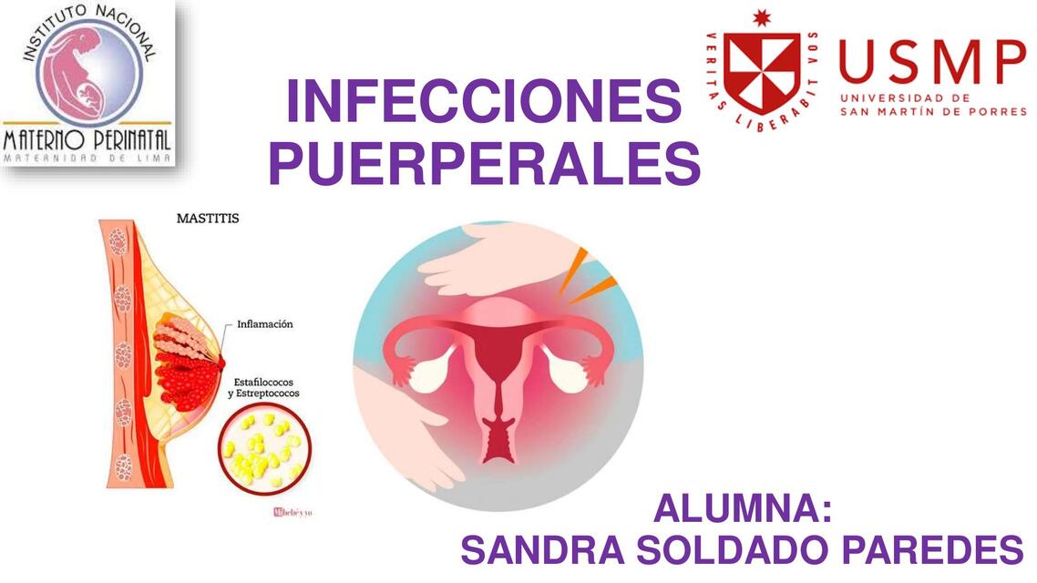 Infecciones puerperales 