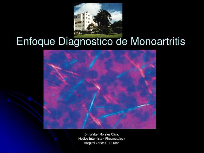 enfoque diagnóstico de Monoartritis