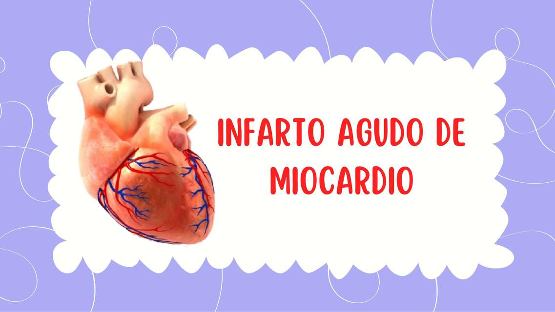 Infarto