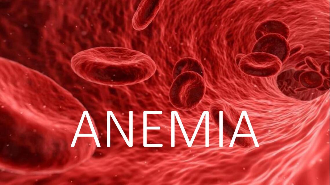 Anemia