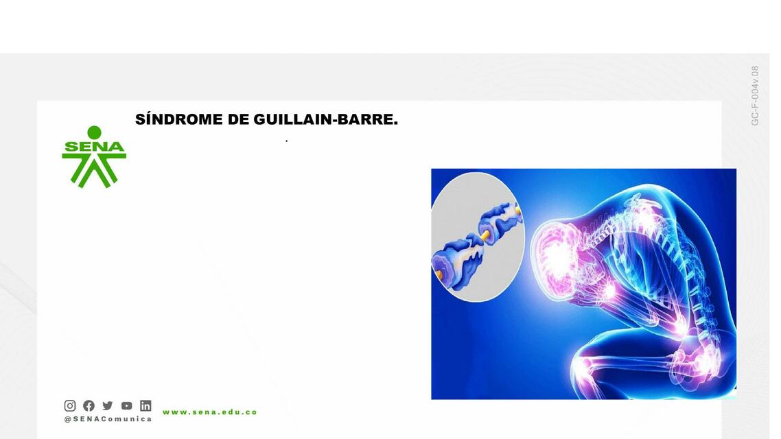 Síndrome de Guillain Barre