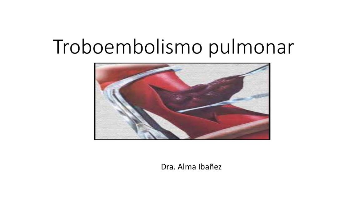 Tromboembolismo pulmonar  