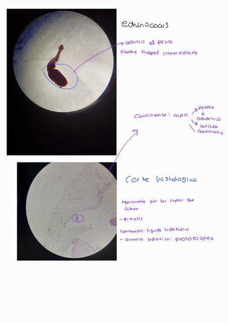 Parasitología