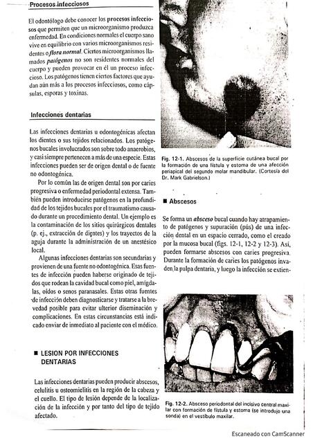 Diseminación de infecciones dentales