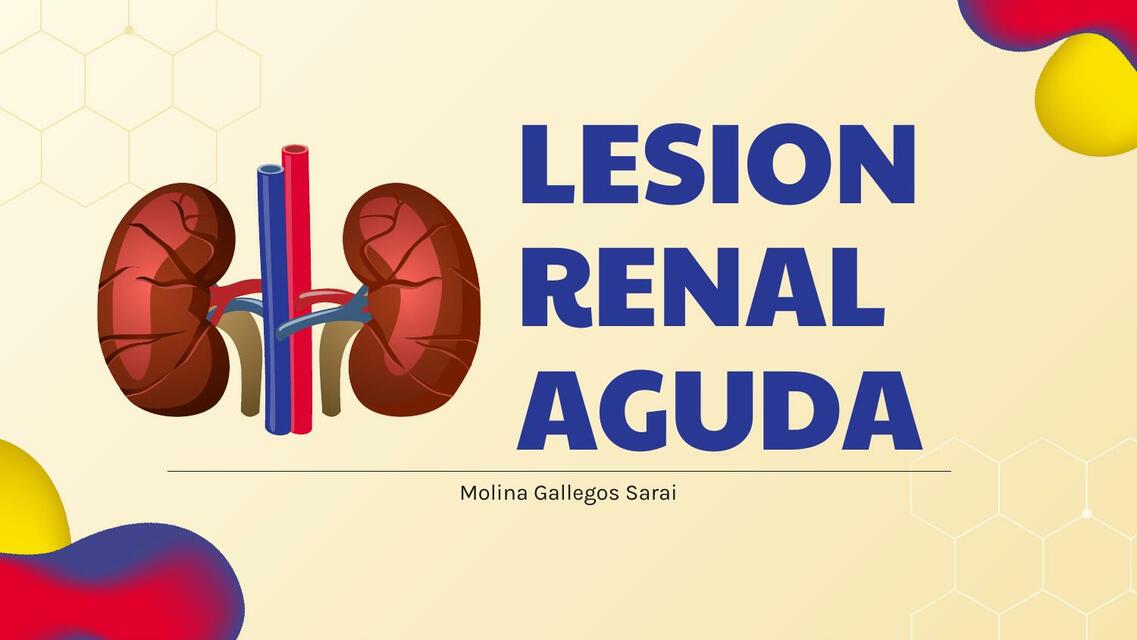 Lesión Renal Aguda Sarai Molina Udocz