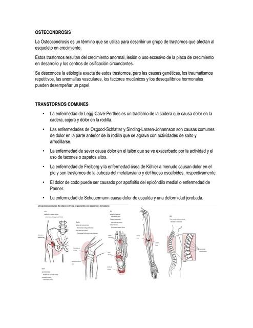 Osteocondrosis  