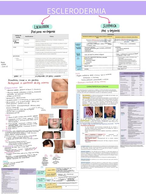 Esclerodermia 