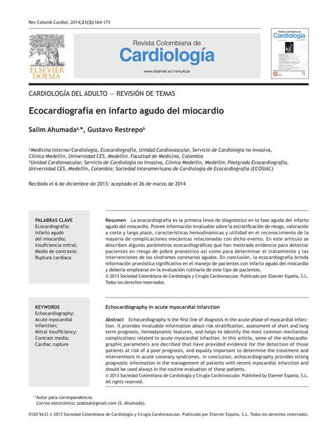 Ecocardiograma en IAM