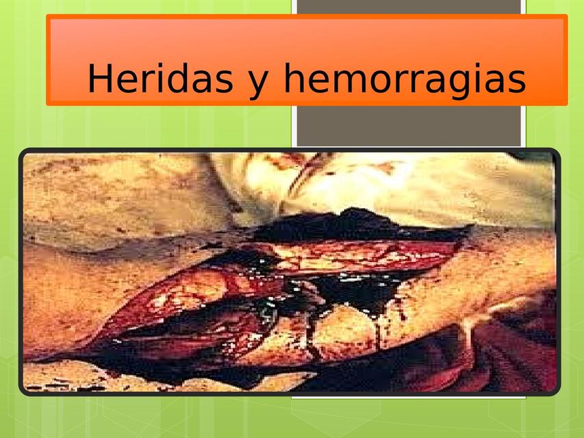 Heridas y hemorragias