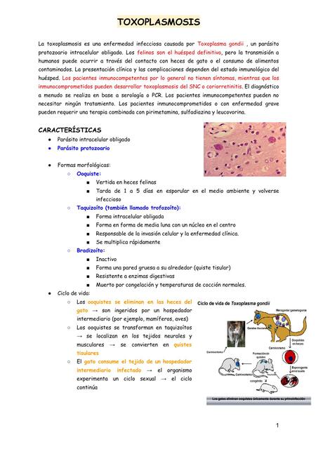 Toxoplasmosis