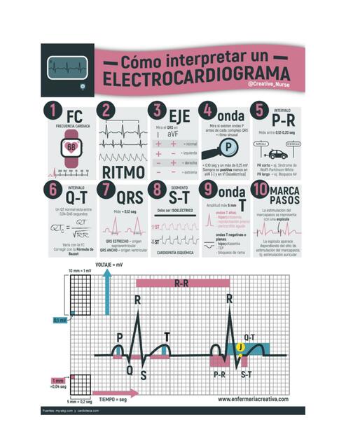 Cómo Interpretar un Electrocardiograma 