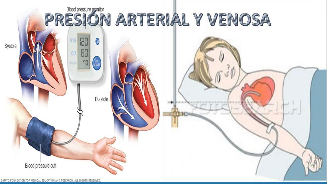 PresiÓn Arterial Enfermedades Salud Udocz