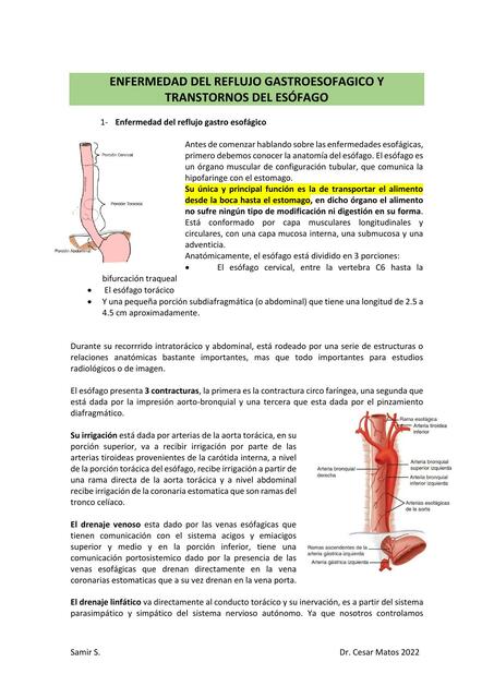 ESOFAGITIS