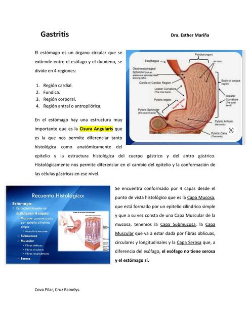 Gastritis 