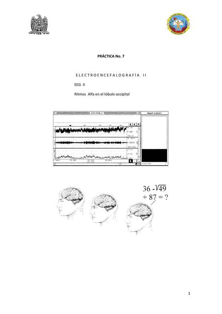 Práctica 7 Electroencefalografía 