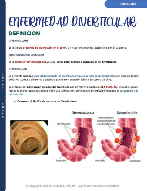  Enfermedad Diverticular Diverticulosis Diverticu