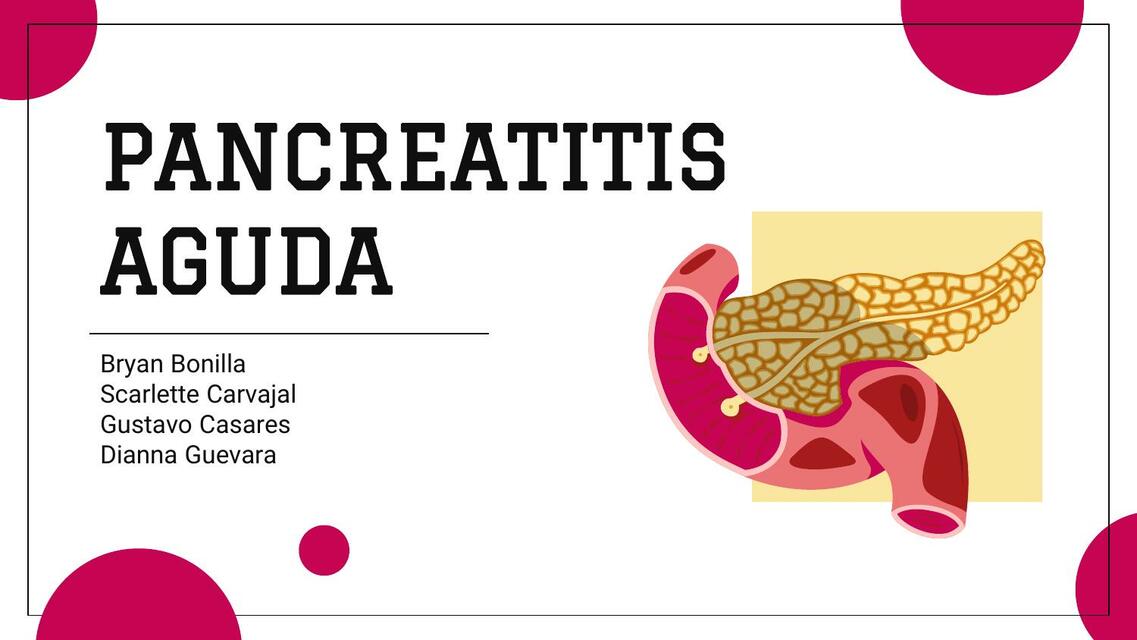 Pancreatitis aguda 