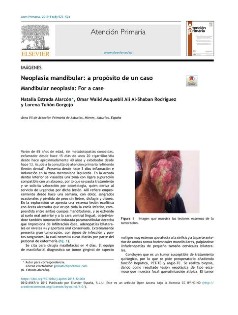 Neoplasia Mandibular 