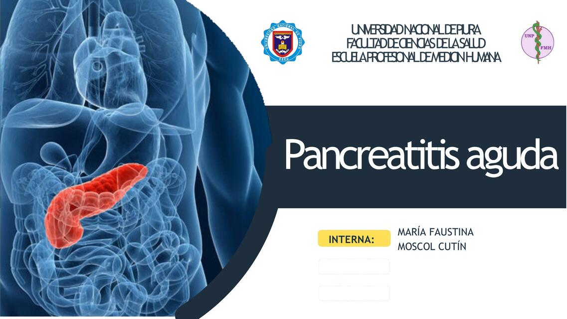 Pancreatitis aguda 