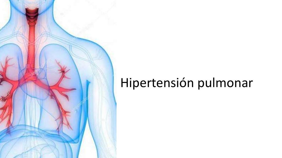 Hipertensión Pulmonar 