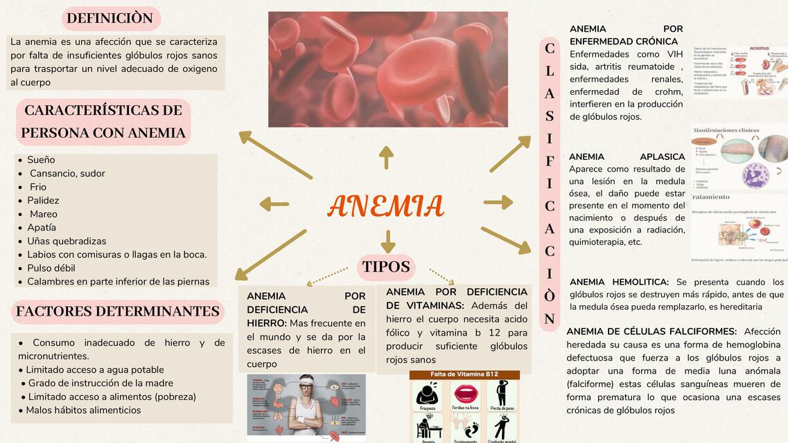 Anemia 