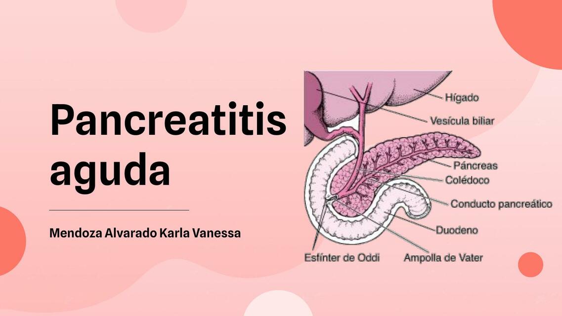 Pancreatitis Aguda 