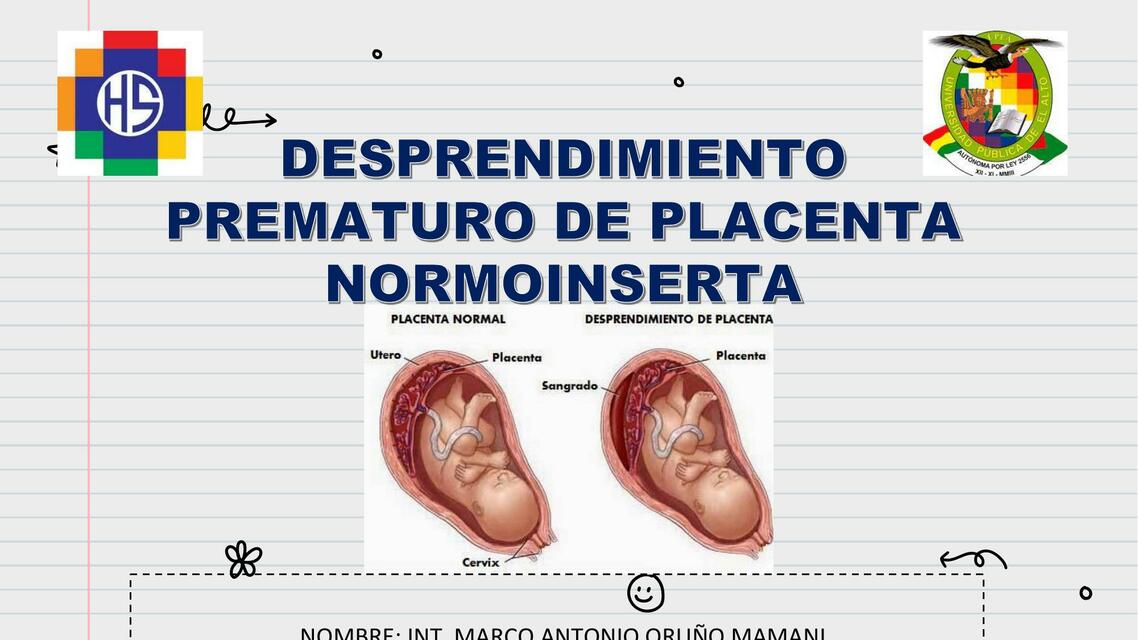 Desprendimiento prematuro de placenta normoinserta 