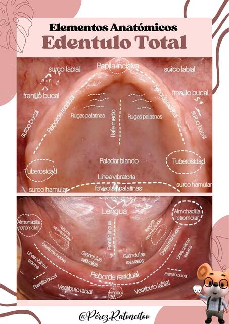 Elementos Anatómicos Edentulo Total