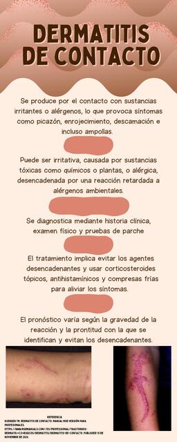 Dermatitis de contacto 