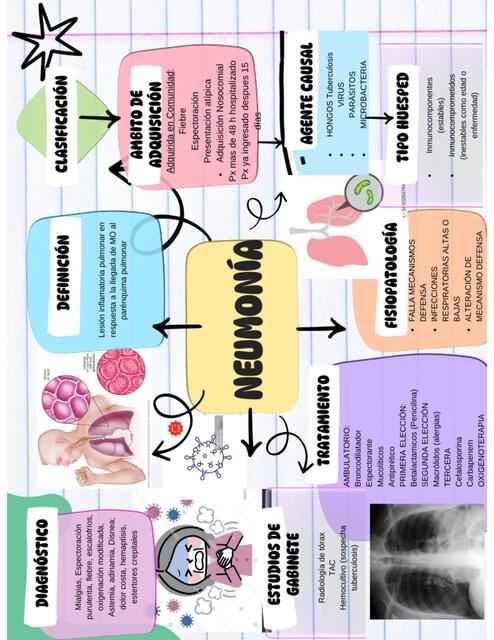 Neumonía 