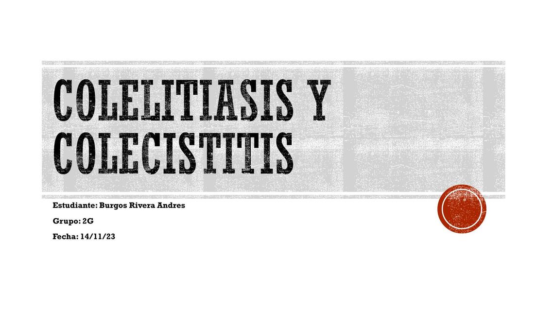 Colelitiasis y colecistitis