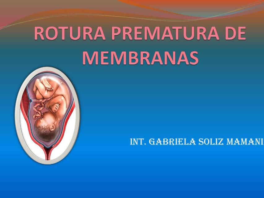 Rotura prematura de membranas 