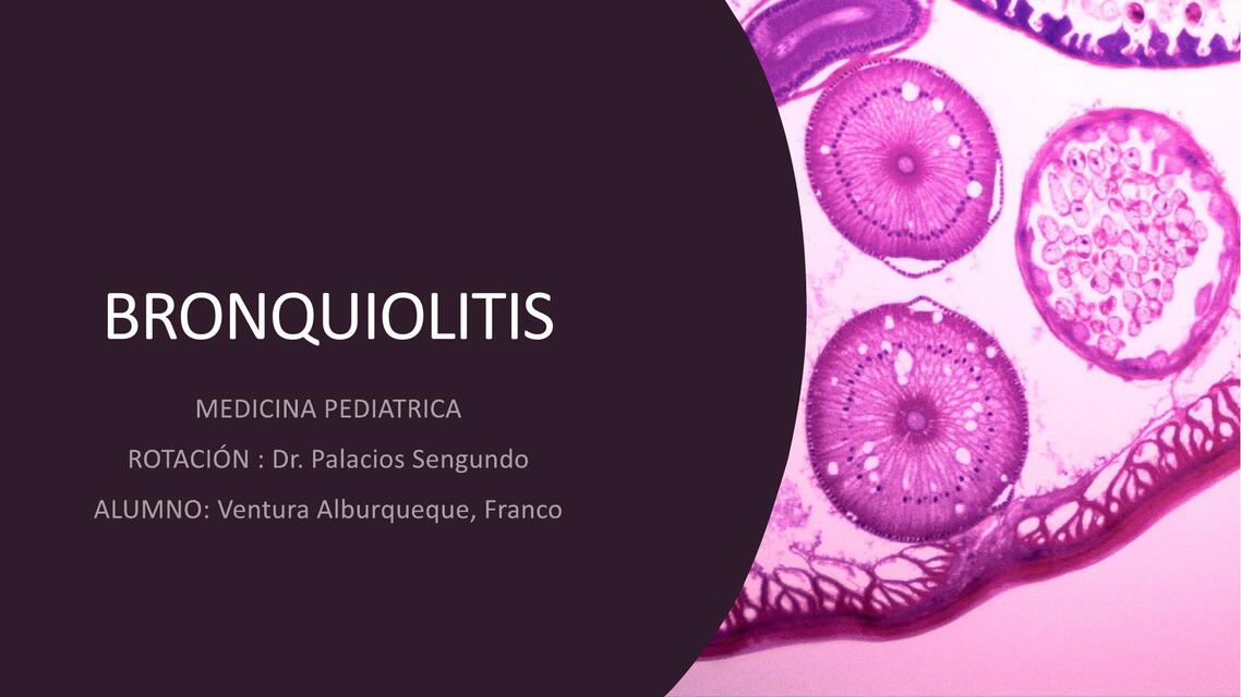 Bronquiolitis 