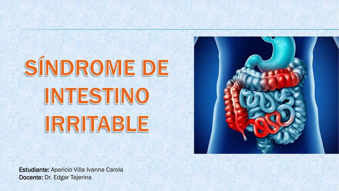 Síndrome de intestino irritable 