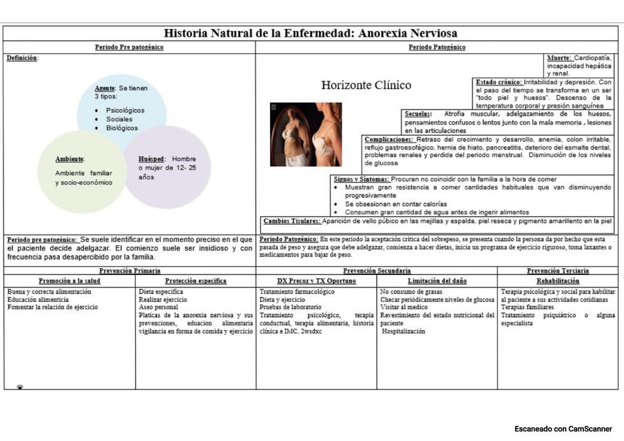 Historia natural de la enfermedad: Anorexia Nerviosa 