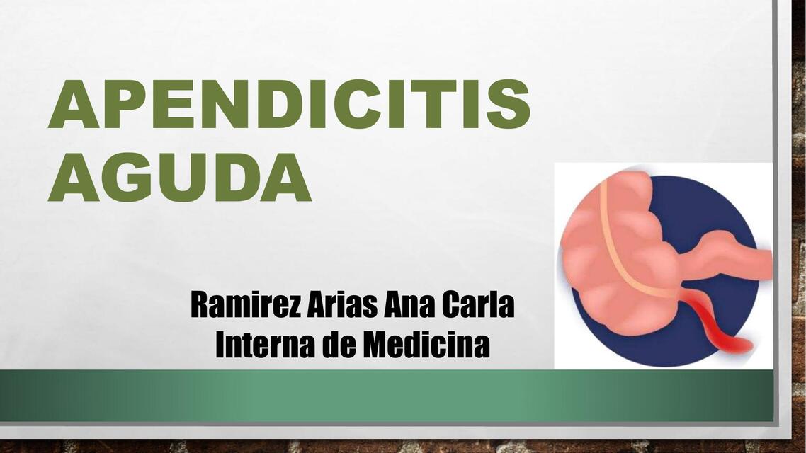 Apendicitis Aguda 