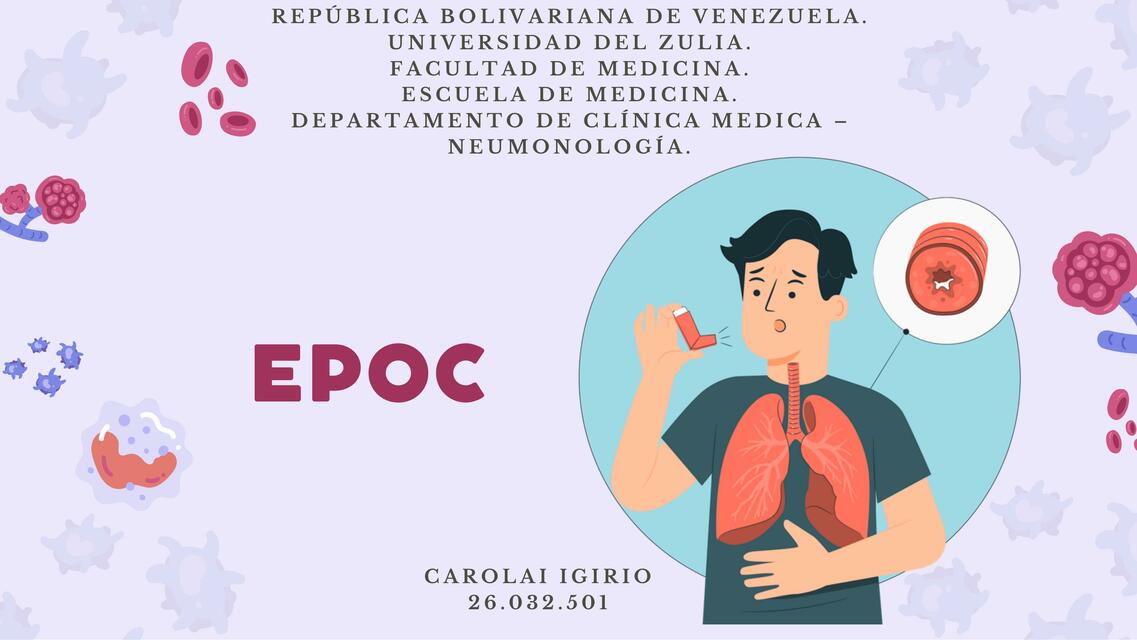 EPOC 